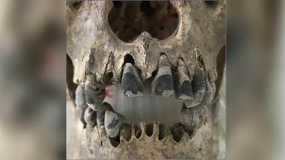 越南古代染黑牙齒：鐵器時代社群如何打造延續 2,000 年的美學標準